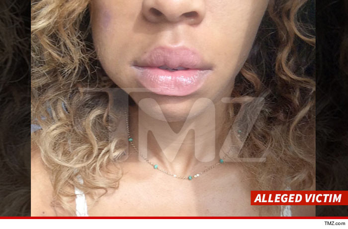 0418-simone-sheperd-jaw-3